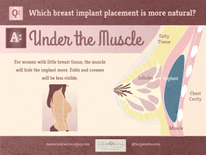 under the muscle breast implants placement
