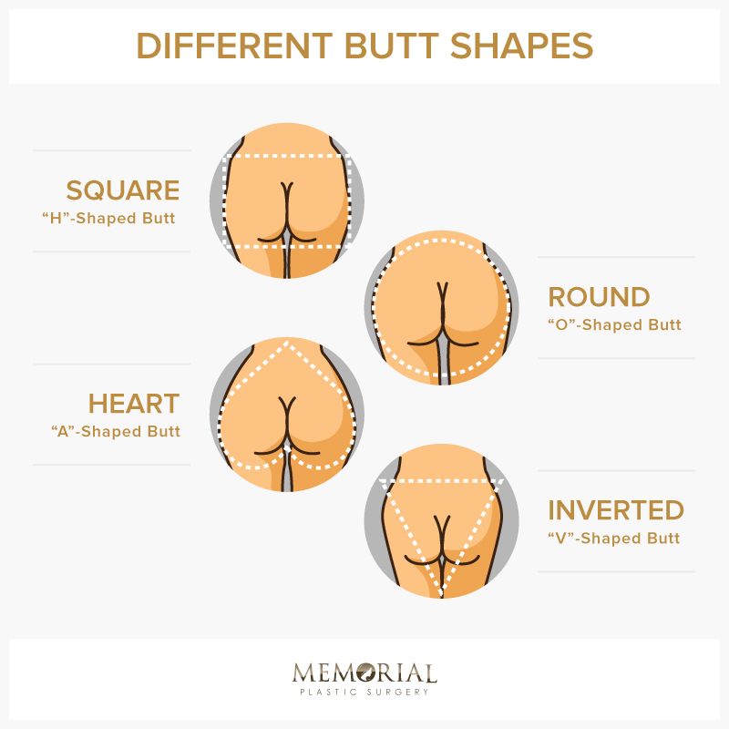 Four different butt shapes by Memorial Plastic Surgery.