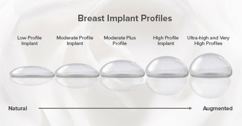 breast implant profiles