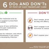 post op hair transplant dos and donts infographics