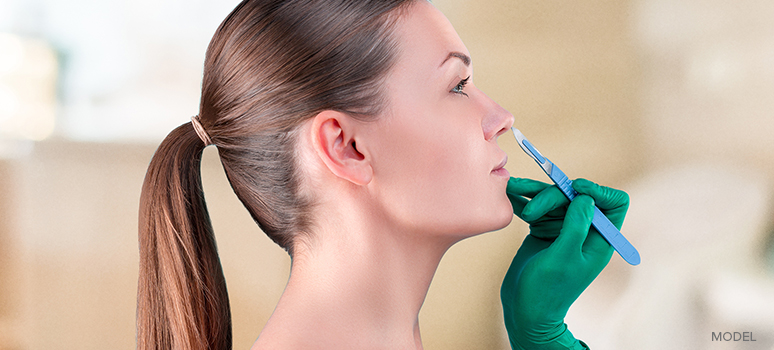 Non-Surgical vs. Surgical Rhinoplasty