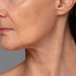 facelift incisions and their Benefits