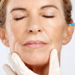 Will Fillers Affect My Future Facelift?