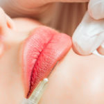 What are Temporary Lip Fillers?